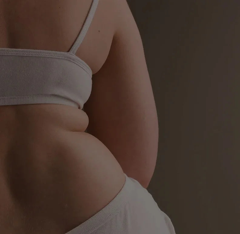 area depicting area of injection for fat dissolving injections at privi studios