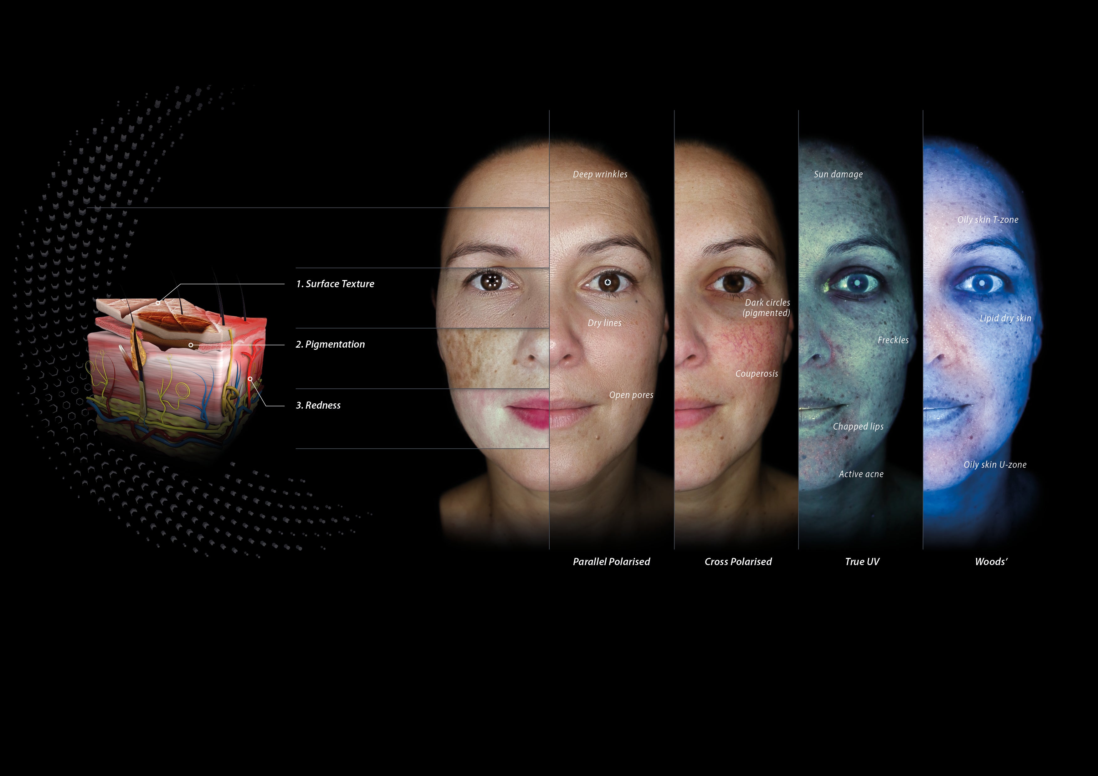 image depicting different light visuals by observ skin analysis on womans face