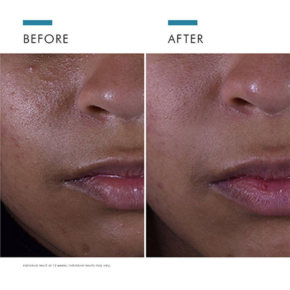 Silymarin CF