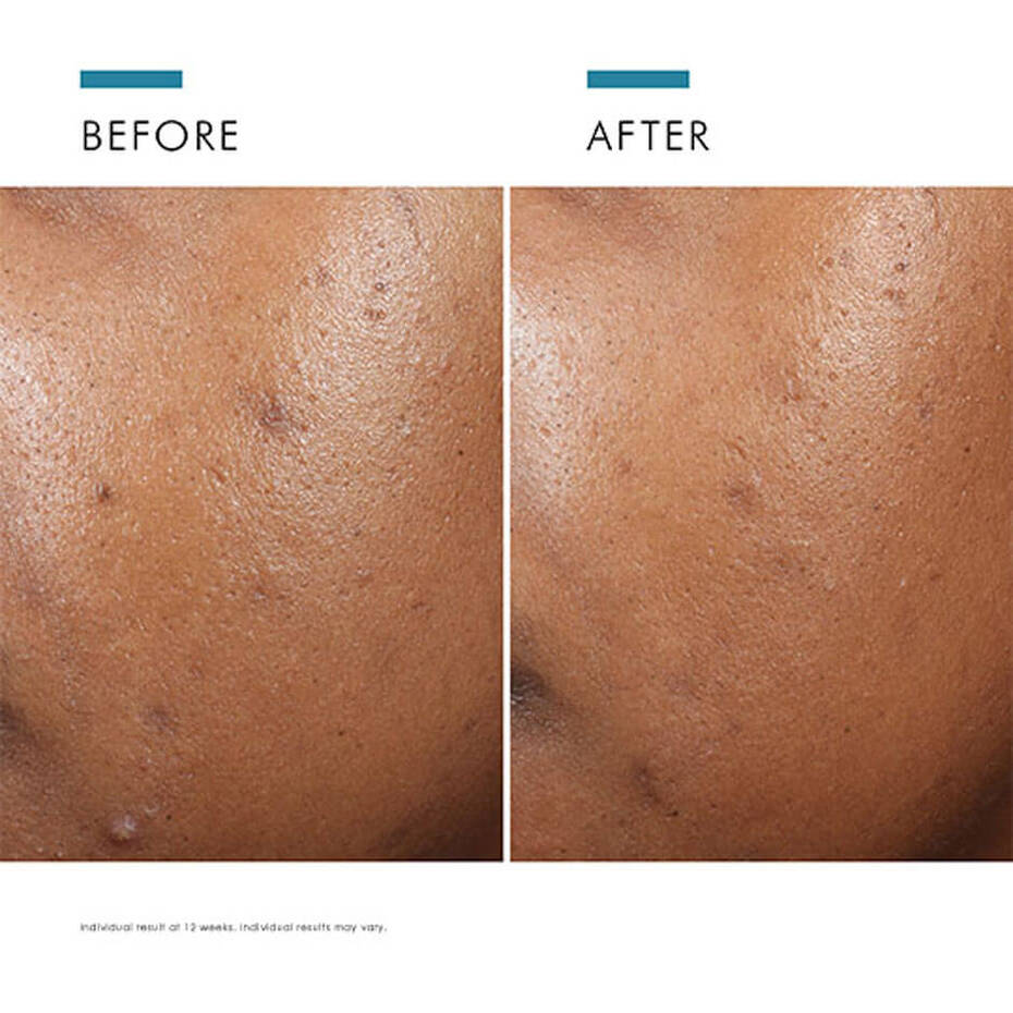 Phyto A+ Brightening Moisturiser