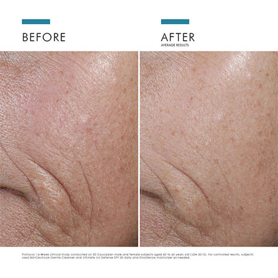 C E Ferulic